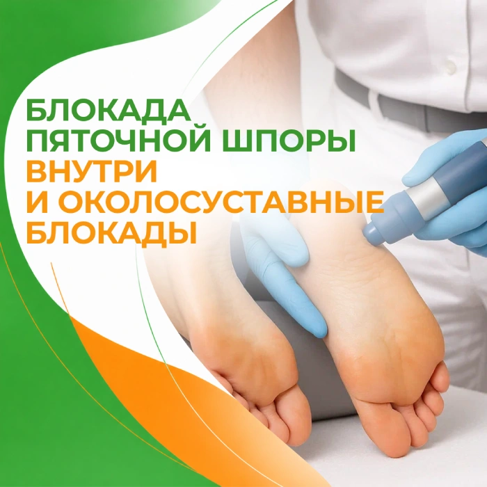 Методы лечения пяточной шпоры в медицинской клинике ПерсонаМед Ухта