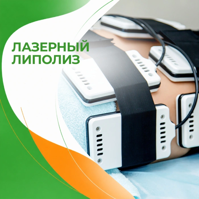 Лазерный липолиз в медицинской клинике ПерсонаМед Ухта