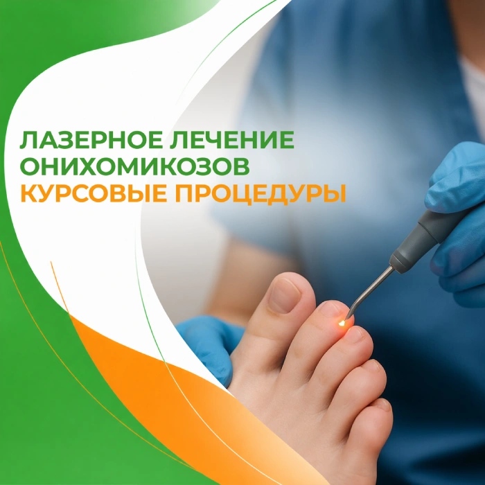 Лечение грибка ногтя в медицинской клинике ПерсонаМед Ухта