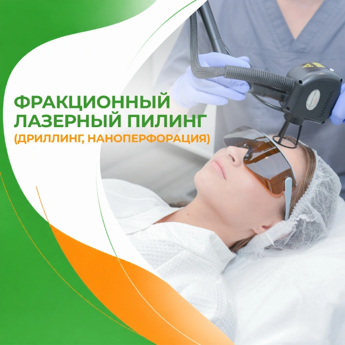 Наноперфорация в медицинской клинике ПерсонаМед Ухта