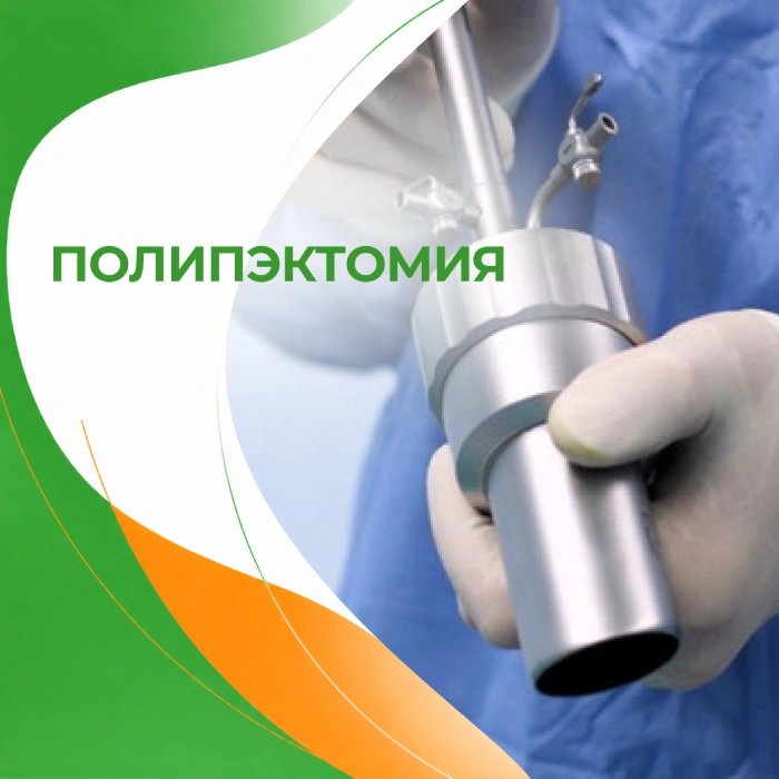 Полипэктомия в медицинской клинике ПерсонаМед Ухта