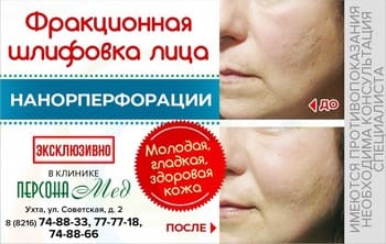 Фракционная шлифовка лица в медицинской клинике ПерсонаМед Ухта